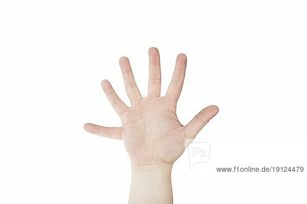 Hand mit sechs Fingern