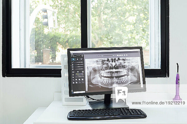 Teeth X-ray on computer at desk in clinic