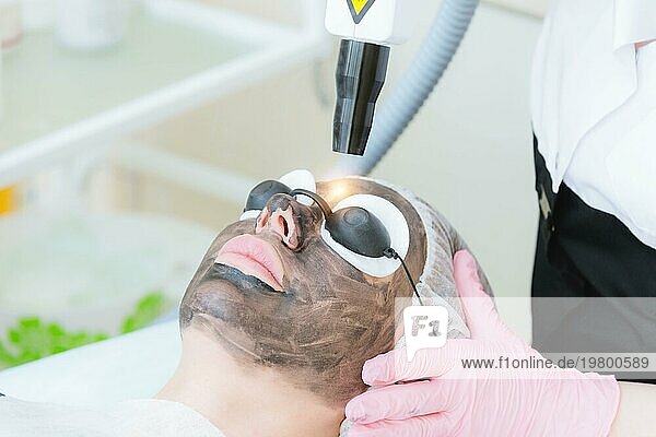 Nahaufnahme des Carbon Face Peeling Verfahrens. Laserimpulse reinigen die Haut des Gesichts. Hardware Kosmetologie Behandlung. Prozess der Photothermolyse  Erwärmung der Haut  Laser Kohlenstoff Peeling. Verjüngung der Gesichtshaut