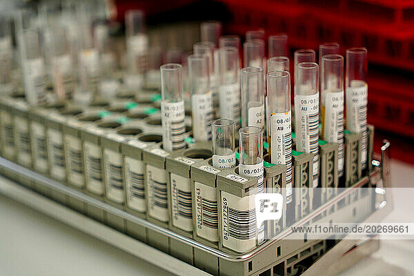 Technical platform of the Inovie 34 laboratory . Preanalytical tubes in racks on the sorter