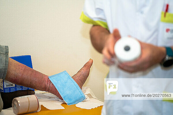 Care of a patient's foot ulcer. Wound cleaning and dressings.