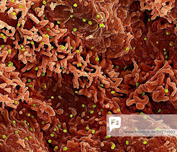 Colorized scanning electron micrograph of monkeypox virus (green) on the surface of infected VERO E6 cells (red).