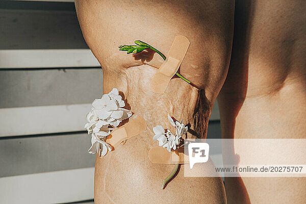 Flowers sticked with bandage on scar of woman's leg
