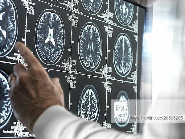 Hand of scientist touching MRI report on screen of computer in laboratory