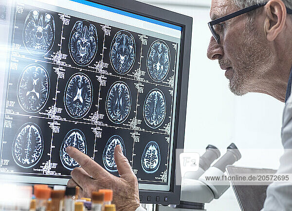 Scientist doing research on MRI report in laboratory