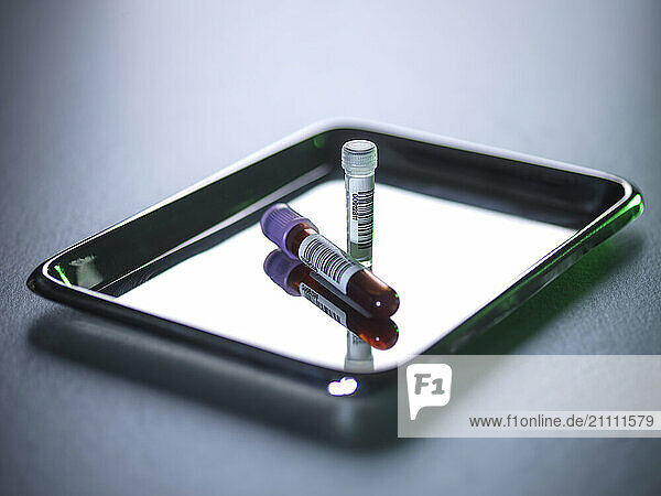 Blood and DNA samples in vials on a metal tray used for medical testing and pharmaceutical research.