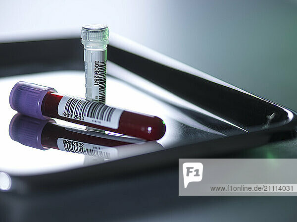 Blood vials and DNA samples for medical testing and research.